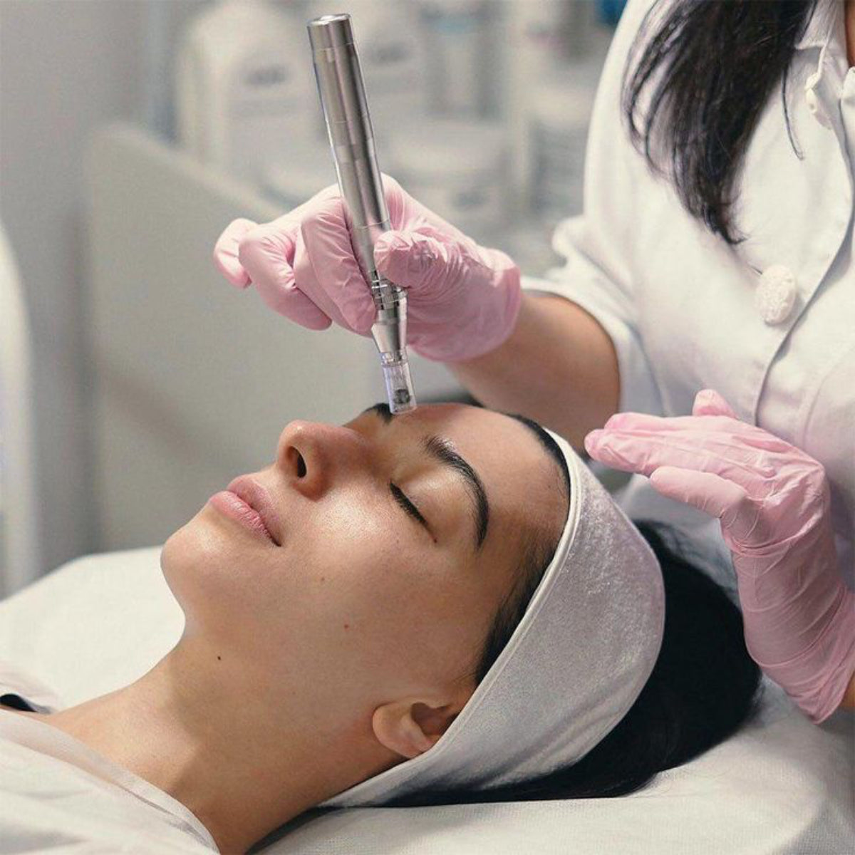 Microneedling – Expert Vendôme